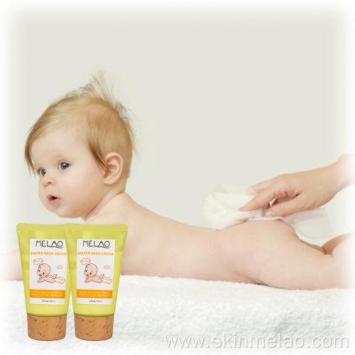 Organic Baby Diaper Rash Cream For Moisturizing